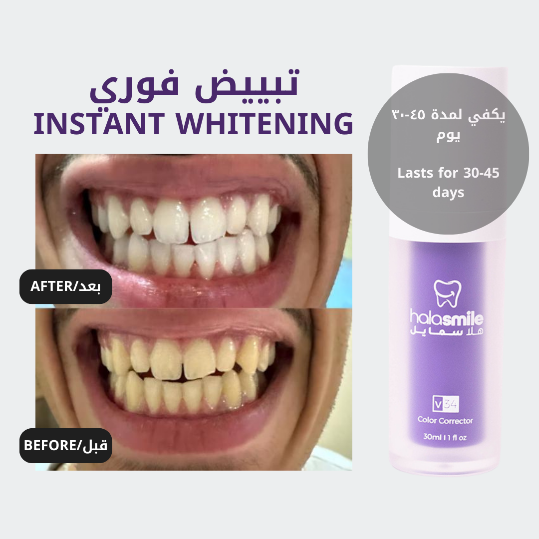 الباقة المميزة