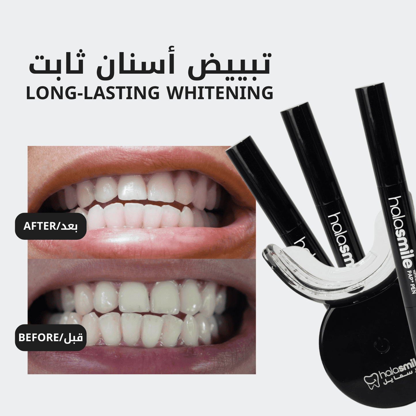 Pack of 3 - The Teeth Whitening Device