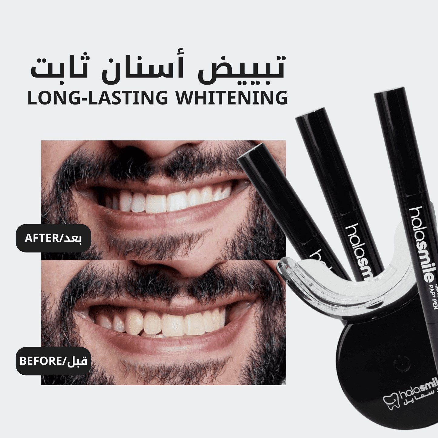 Pack of 2 - The Teeth Whitening Device
