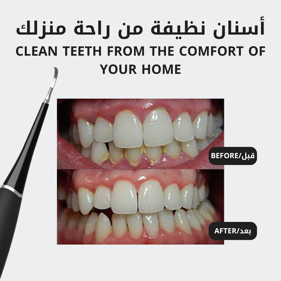 The Ultrasonic Plaque Remover